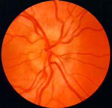 Neuro-ophthalmology_clip_image002 Neuro-ophthalmology_clip_image002