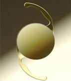 Refractive_Surgery_clip_image005