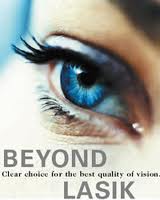 ICL instead of lasik laser surgery