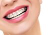 dental wiring braces treatment cost at Harpreet Eye and Dental Care Centre Jalandharjalandhar punjab india