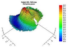 contoura vision laser price jalndhar punjab india
