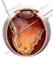 contact_lenses_and_spectacles_clip_image009