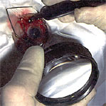 contact_lenses_and_spectacles_clip_image011