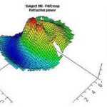 lasik eye surgery Jalandhar Punjab