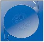 Multifocal lens surgery at Harpreet Ete and Dental Care Centre Jalandhar