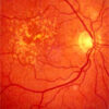 eye26 eye26