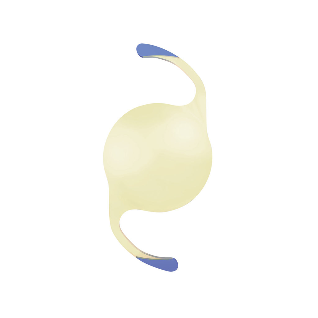 mics cataract surgery jalandhar punjab india