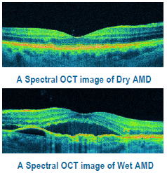 oct retina jalandhar punjab