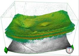 oct retina jalandhar punjab