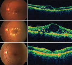 oct retina jalandhar punjab