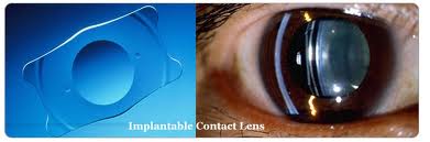 phacoemulsification_clip_image001