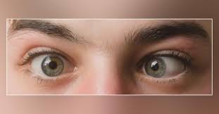 neuro ophhalmology neuro ophhalmology