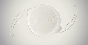 multifocal lense surgery jalandhar punjab