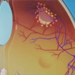 retinal lasers jalandhar punjab