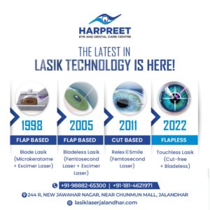 smart pulse laser smile silk laser flapless cut less