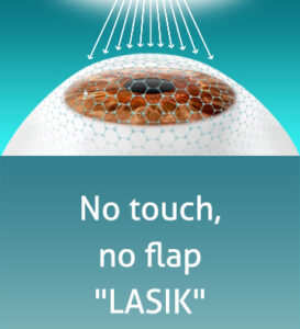 silk laser touchless smart surf laser