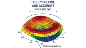 lasik eye surgery eligiblity in jalandhar punjab