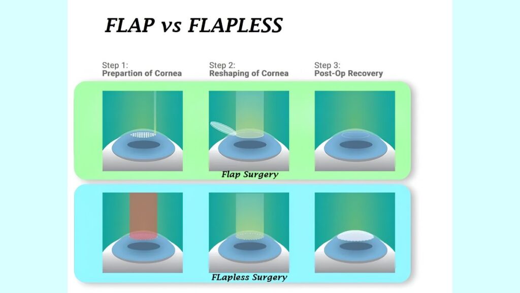 best lasik laser surgery jalandhar punjab