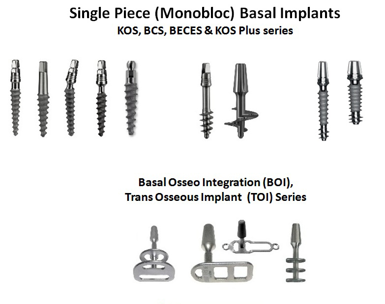 3 DAYS DENTAL IMPLANTS JALANDHAR