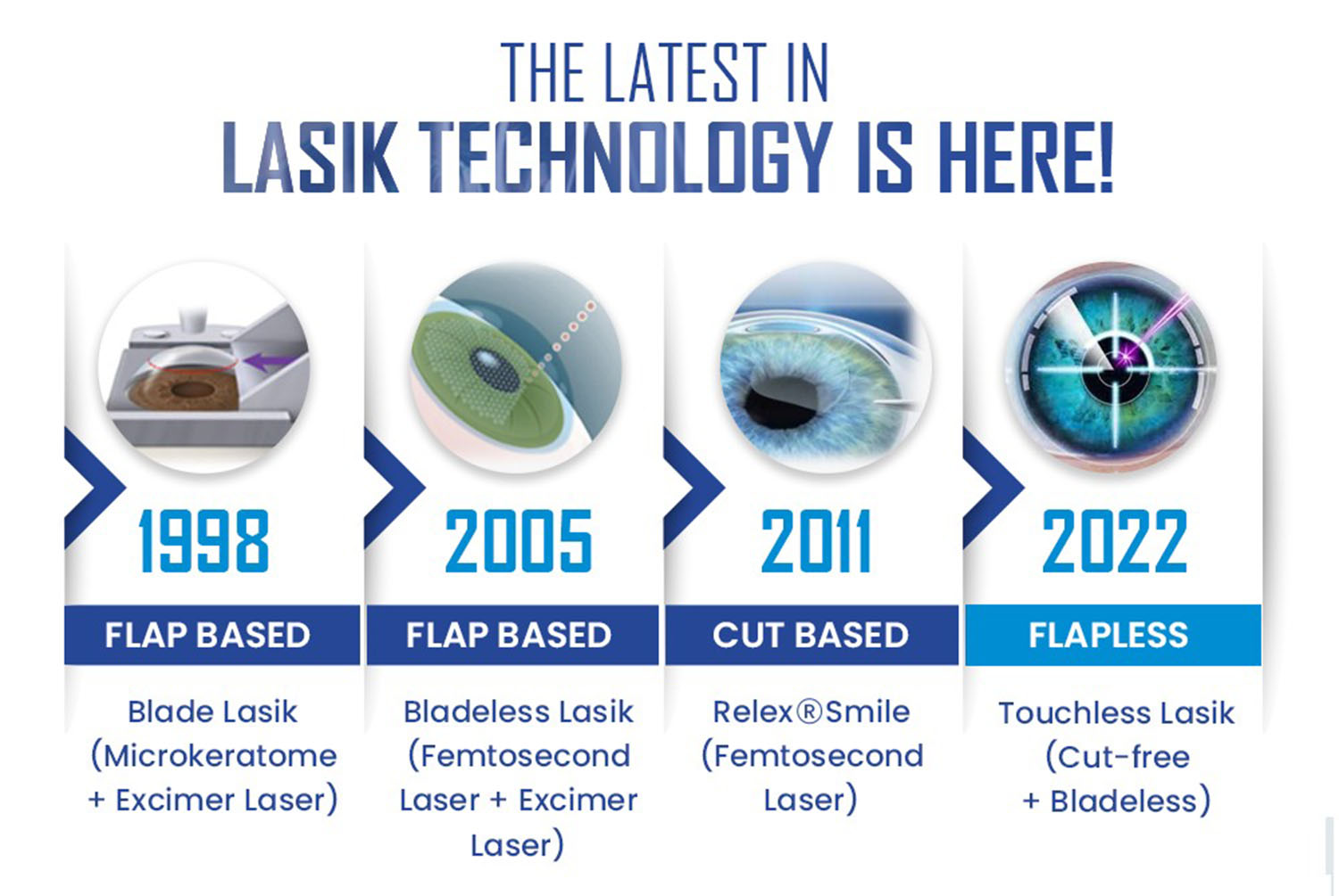 Touchless Bladeless Flapless Lasik Eye Surgery Jalandhar Punjab
